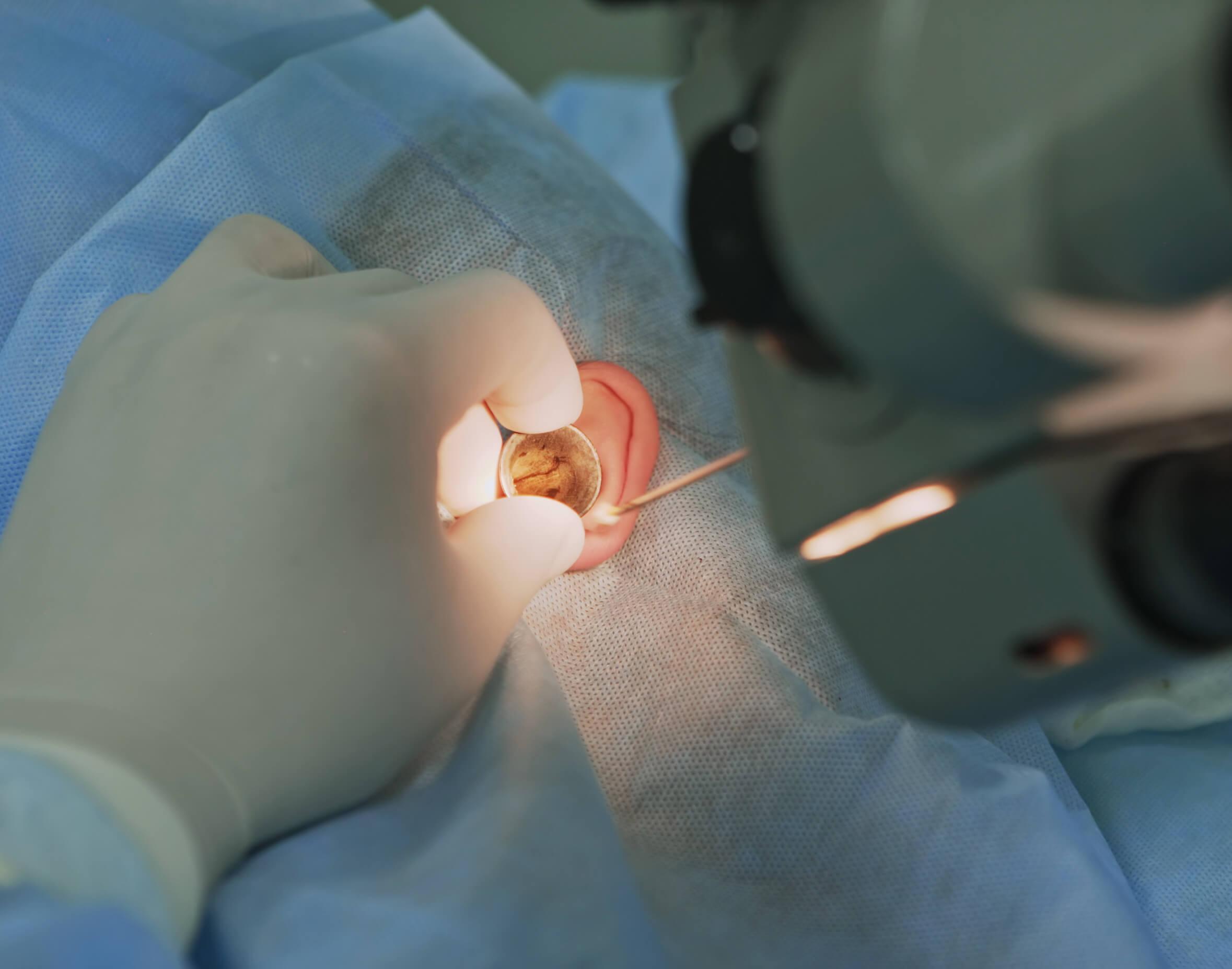 ear check during surgery